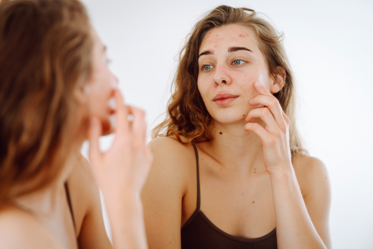 Botanical Face Oil for Dry Skin: How to Choose