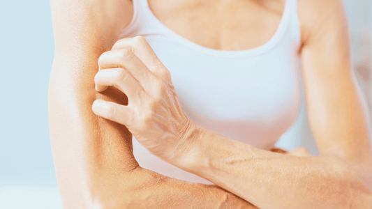 Eliminate Eczema: An exhaustive Guide